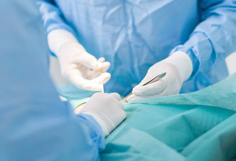 提携病院にて手術対応