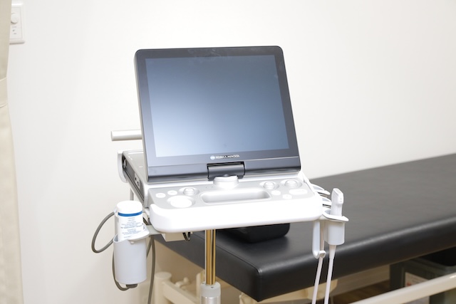 超音波診断装置